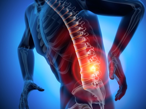 Choosing an Office Chair for Herniated Discs: 5 Essential Features to Check First